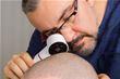Best Hair Transplant Surgeons in Turkey