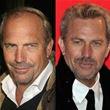 Hair Transplants Are On The Rise and Here's Why