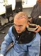 Getting A Hair Transplant Is No Longer Taboo