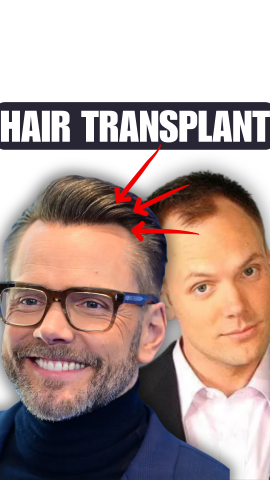 Joel McHale Thanks Dr. Parsa Mohebi for Hair Transplant on Bert Kreischer Podcast
