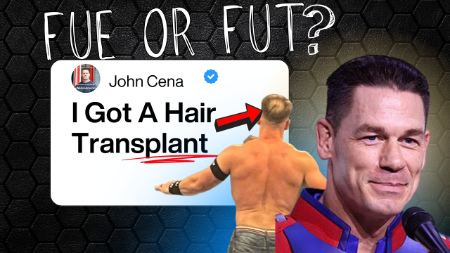 John Cena Hair Transplant: Did He Get FUE or FUT?