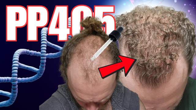 BREAKING NEWS: PP405 Phase 2a Results: A New Frontier in Hair Follicle Regeneration