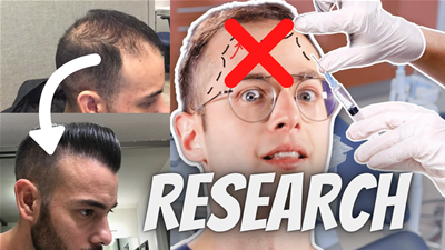How To Choose The Best Hair Transplant Surgeon For You
