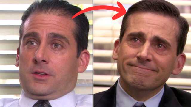 Did Steve Carrell Get A Hair Transplant?