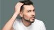 How Do You Know If You're Going Bald and What Are The Treatments?