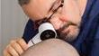 Best Hair Transplant Surgeons in Turkey