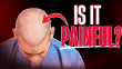 Are Hair Transplants Painful? The TRUTH