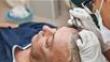 How Many Hair Transplants Can You Have Over A Lifetime