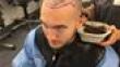 Getting A Hair Transplant Is No Longer Taboo