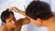The Biggest Myths About Genetic Hair Loss