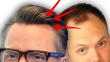 Joel McHale Thanks Dr. Parsa Mohebi for Hair Transplant on Bert Kreischer Podcast