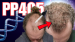 BREAKING NEWS: PP405 Phase 2a Results: A New Frontier in Hair Follicle Regeneration