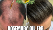 Does Rosemary Oil Stop Hair Loss