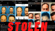 How To Research Hair Transplant Surgery and Clinics