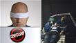 Censorship In The Hair Transplant Industry Is A Real Problem