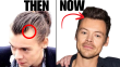 Did Harry Styles Get a Hair Transplant? A Closer Look at the Rumors
