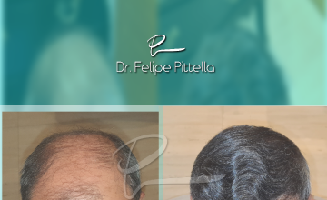 Dr. Pittella • Norwood 6: SOLVED