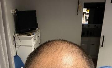 Dr Ruk 3069 Grafts