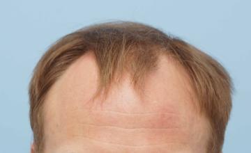 Dr B Farjo 2200g FUT