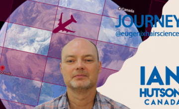 Know why Ian researched for years before choosing hair restoration clinic @Eugenix Hair Sciences