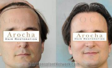 Before and after  photographs