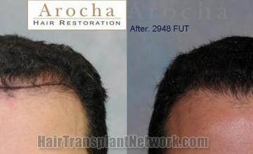 Front view - Before and after