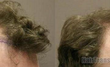 Right views showing patient preoperative to 