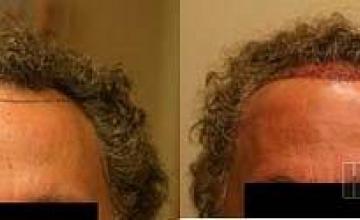 photos