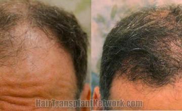 before and after images