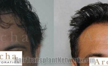 Before and after pictures